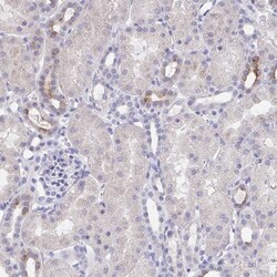 KCNK5 Antibody, Novus Biologicals:Antibodies:Primary Antibodies
